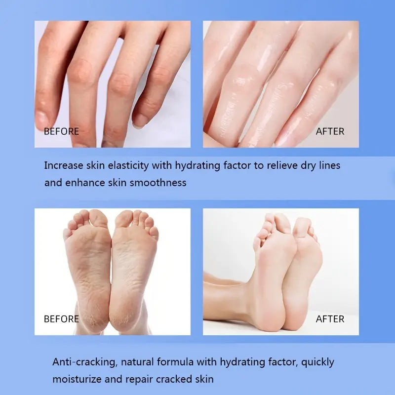 Vaseline Anti-Cracked Cream Moisturizing Stick
