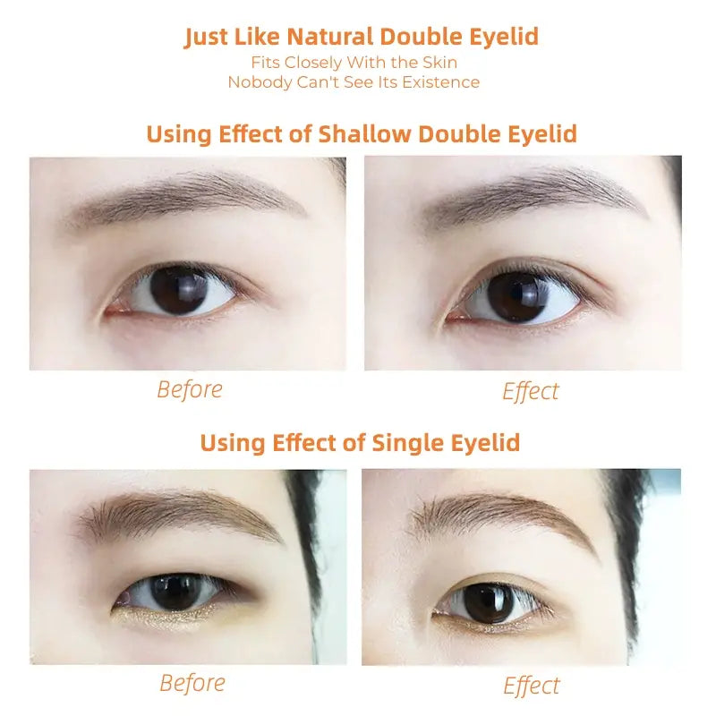 Self Adhesive Eyelid Lift Strips